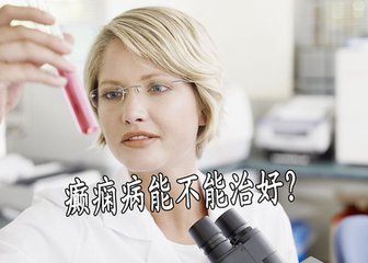 癫痫大发作怎么治疗好