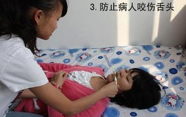 突发性癫痫该怎么急救