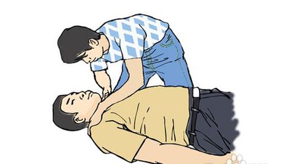 癫痫发作的急救方法