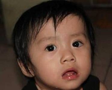 小儿癫痫小发作症状有什么
