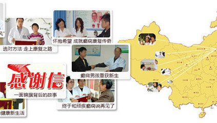 治疗癫痫杭州哪家医院好