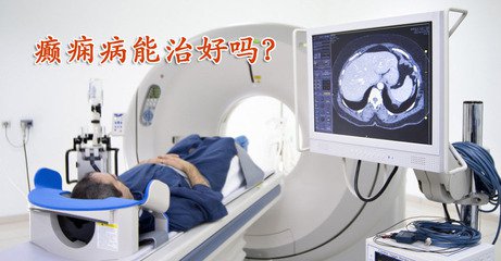 继发性癫痫能否治愈